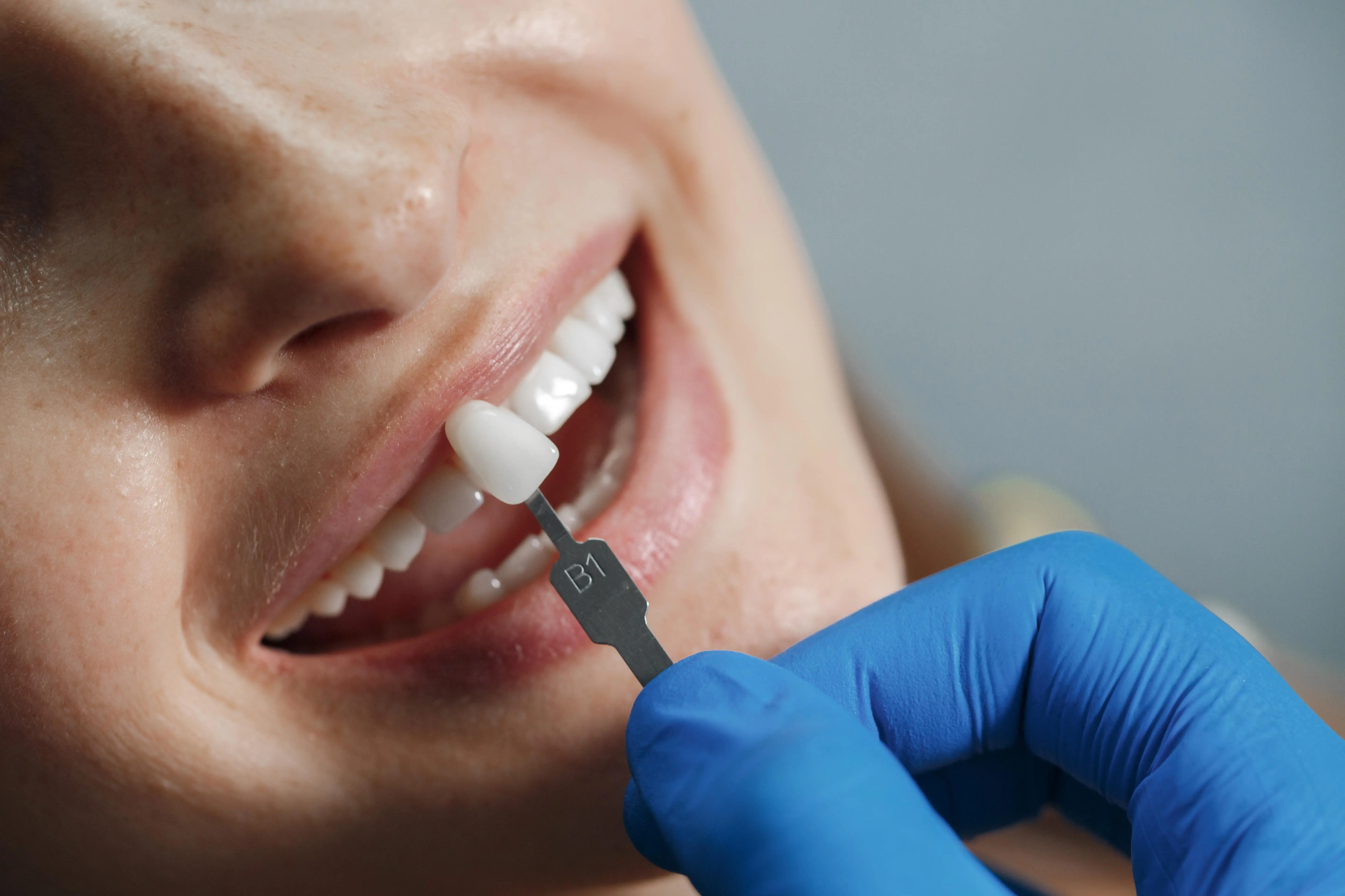 Dentures, artificial teeth: Complete dentures and Partial dentures.